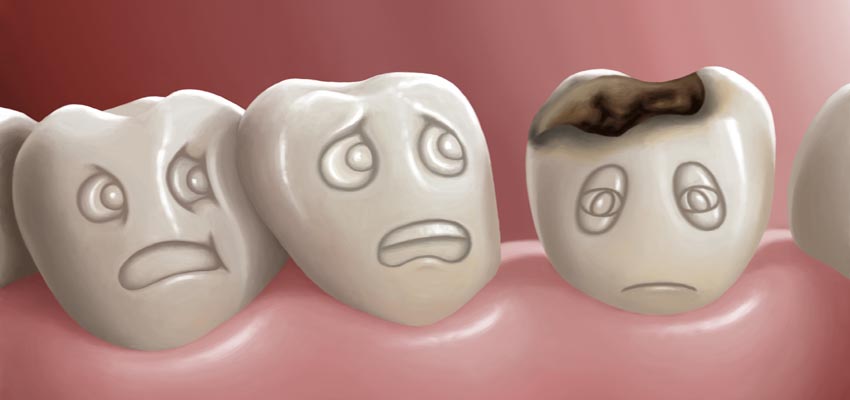 Diş Çürüğü Nedir? Nasıl Önlenir? | Kartal Diş Hekimi